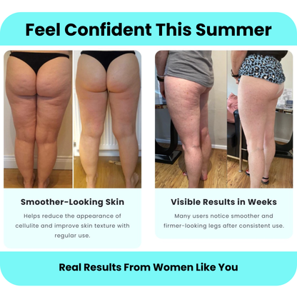 Veloura™ RPM Sculpt Roller - Anti-Cellulite