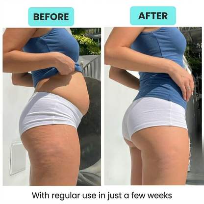 Veloura™ RPM Sculpt Roller - Anti-Cellulite