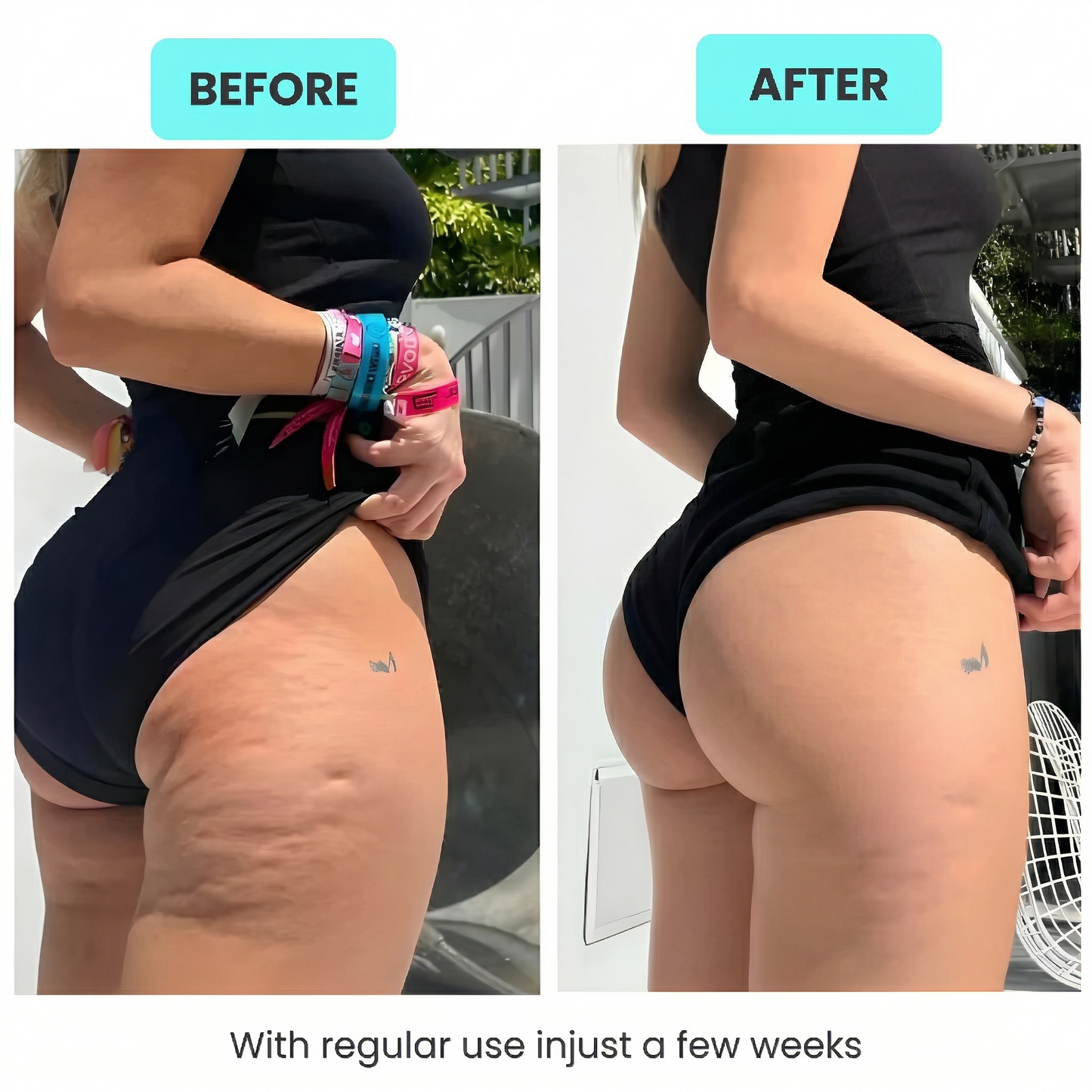 Veloura™ RPM Sculpt Roller - Anti-Cellulite